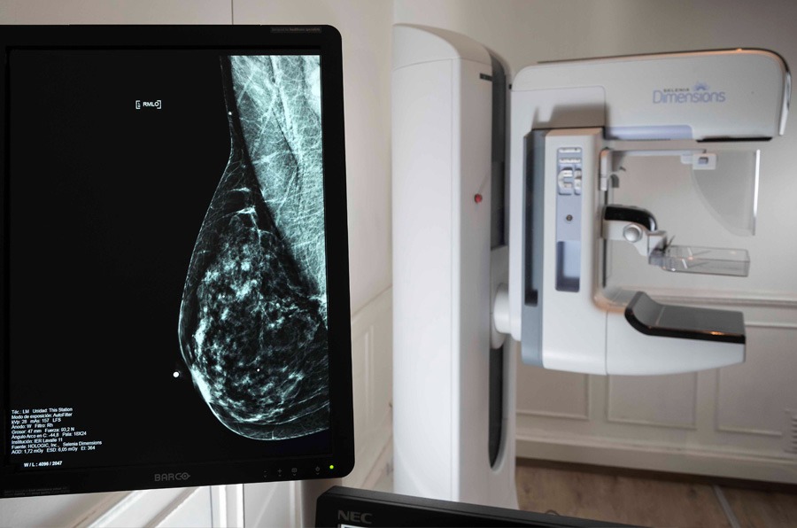 LALCEC realiza mamografías gratuitas para prevenir el cáncer de mama ...